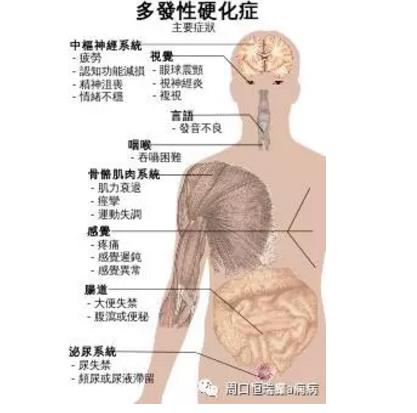 恒瑞王大夫解析其他原因性癫痫